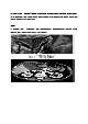 신규간호사도 이해할 수 있게 만든 담관염 자료(시술 및 이미지)   (3 페이지)